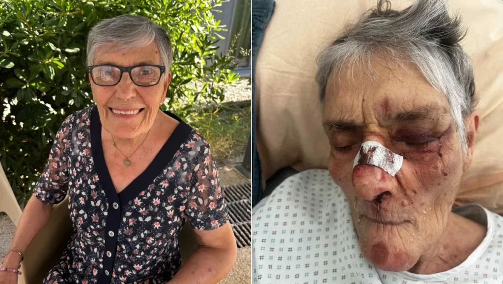 Résidente en EHPAD ayant subi des blessures